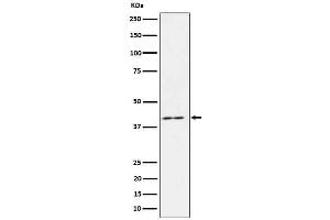 Western blot analysis of IL18 binding protein in HeLa cell lysate.
