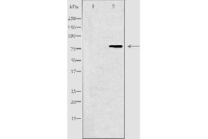 Western blot analysis of extracts from Jurkat cells, using DVL3 antibody.