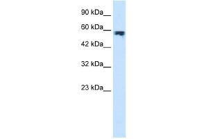 WB Suggested Anti-ZYX Antibody Titration:  1.
