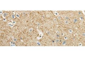 Immunohistochemistry (Paraffin-embedded Sections) (IHC (p)) image for anti-Wingless-Type MMTV Integration Site Family Member 2 (WNT2) antibody (ABIN7244441)