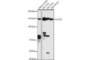 Western blot analysis of extracts of various cell lines, using L antibody (ABIN7268192) at 1:500 dilution.
