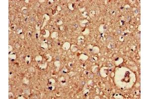 Immunohistochemistry of paraffin-embedded human brain tissue using ABIN7154637 at dilution of 1:100 (GTPase NRas Antikörper  (AA 1-186))