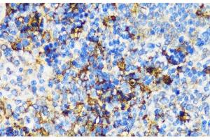 Immunohistochemistry of paraffin-embedded Mouse spleen using PBEF / NAMPT Polyclonal Antibody at dilution of 1:100 (40x lens). (NAMPT Antikörper)