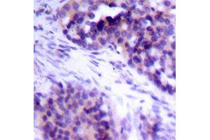 Immunohistochemistry (IHC) image for anti-BCL2-Like 1 (BCL2L1) (pSer62) antibody (ABIN3020106) (BCL2L1 Antikörper  (pSer62))