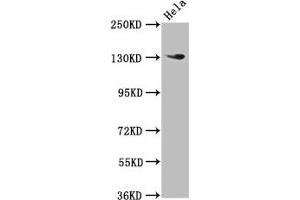 Western Blot Positive WB detected in: Hela whole cell lysate All lanes: NOMO1 antibody at 3 μg/mL Secondary Goat polyclonal to rabbit IgG at 1/50000 dilution Predicted band size: 135 kDa Observed band size: 135 kDa (NOMO1 Antikörper  (AA 918-1044))