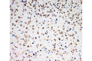 Anti-TrkC antibody, IHC(P): Rat Brain Tissue