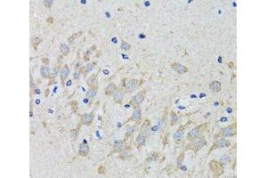 Immunohistochemistry of paraffin-embedded Mouse brain using HTR2B Polyclonal Antibody at dilution of 1:100 (40x lens). (Serotonin Receptor 2B Antikörper)