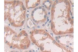 Detection of CTSS in Human Kidney Tissue using Polyclonal Antibody to Cathepsin S (CTSS) (Cathepsin S Antikörper  (AA 115-331))