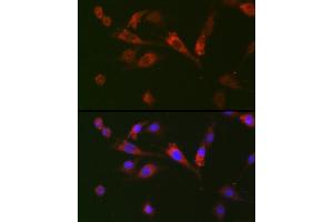 Immunofluorescence analysis of BALB-3T3 cells using GDF15 Rabbit pAb (ABIN3020658, ABIN3020659, ABIN3020660, ABIN1512942 and ABIN6213652) at dilution of 1:100 (40x lens). (GDF15 Antikörper  (AA 49-308))