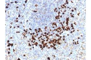 Immunohistochemical staining (Formalin-fixed paraffin-embedded sections) of human tonsil with Lambda Light Chain monoclonal antibody, clone LLC/1738 . (IGLC1 Antikörper)