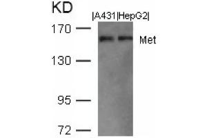 Image no. 1 for anti-Met Proto-Oncogene (MET) (AA 1001-1005) antibody (ABIN401653) (c-MET Antikörper  (AA 1001-1005))