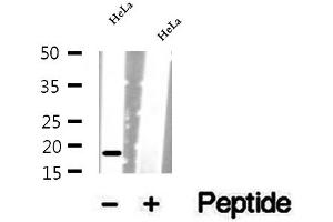 Western blot analysis of extracts of HeLa cells, using SRP14 antibody. (SRP14 Antikörper  (Internal Region))