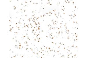 Immunocytochemistry (ICC) image for anti-SWI/SNF Related, Matrix Associated, Actin Dependent Regulator of Chromatin, Subfamily E, Member 1 (SMARCE1) (C-Term) antibody (ABIN7795730)
