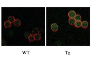 IF staining of Drak2 in WT versus Tg T cells. (DRAK2 Antikörper  (C-Term))