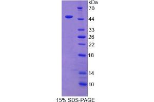 Image no. 1 for Neurotrophic tyrosine Kinase, Receptor, Type 3 (NTRK3) (AA 32-429) protein (His tag) (ABIN4989046)