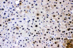 PC4 was detected in paraffin-embedded sections of mouse liver tissues using rabbit anti- PC4 Antigen Affinity purified polyclonal antibody (Catalog # ) at 1 µg/mL.