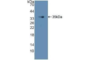 Detection of Recombinant GDI1, Human using Polyclonal Antibody to GDP Dissociation Inhibitor 1 (GDI1) (GDI1 Antikörper  (AA 1-274))