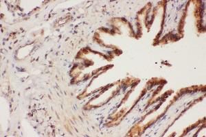 Anti-ALOX15 Picoband antibody,  IHC(P): Rat Lung Tissue