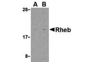 Western Blotting (WB) image for anti-Ras Homolog Enriched in Brain (RHEB) (N-Term) antibody (ABIN1031539) (RHEB Antikörper  (N-Term))