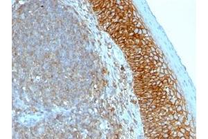 Formalin-fixed, paraffin-embedded human tonsil stained with anti-CD44 antibody (SPM544)