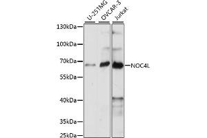 Western blot analysis of extracts of various cell lines, using NOC4L antibody (ABIN7269029) at 1:1000 dilution. (NOC4L Antikörper  (AA 1-260))