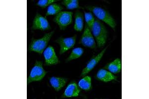 IF analysis of ALPP using anti-ALPP antibody (ABIN7602772). (PLAP Antikörper  (C-Term))