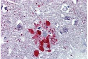 Human Brain, Cortex, Senile Plaque (formalin-fixed, paraffin-embedded) stained with Ubiquitin antibody ABIN462018 at 10 ug/ml followed by biotinylated anti-mouse IgG secondary antibody ABIN481714, alkaline phosphatase-streptavidin and chromogen. (Ubiquitin Antikörper)