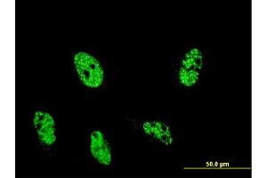 Immunofluorescence of monoclonal antibody to ARID4A on HeLa cell.