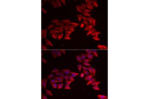 Immunofluorescence analysis of HeLa cells using SFRP4 antibody (ABIN5973810).