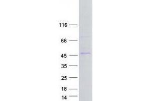 Western Blotting (WB) image for GNAS Complex Locus (GNAS) (Transcript Variant 7) protein (Myc-DYKDDDDK Tag) (ABIN2722096)
