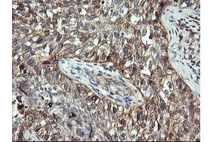 Immunohistochemistry (IHC) image for anti-T-cell surface glycoprotein CD1c (CD1C) antibody (ABIN2670676) (CD1c Antikörper)