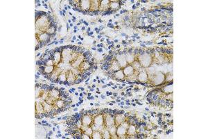 Immunohistochemistry of paraffin-embedded human colon using PTPRA Antibody (ABIN1874458) at dilution of 1:100 (40x lens).