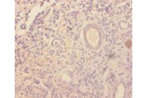 Immunohistochemistry of paraffin-embedded human kidney tissue using ABIN7177029 at dilution of 1:100 (CCL4 Antikörper  (AA 24-92))