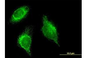 Immunofluorescence of monoclonal antibody to SFTPD on HeLa cell. (SFTPD Antikörper  (AA 21-375))