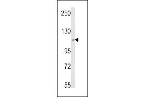 Western blot analysis of SKIV2L2 Antibody (Center) (ABIN652687 and ABIN2842458) in MCF-7 cell line lysates (35 μg/lane). (MTR4 Antikörper  (AA 237-263))