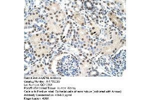 Human kidney (AKAP8L Antikörper  (C-Term))