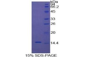 SDS-PAGE (SDS) image for Cystatin C (CST3) (AA 32-148) protein (His tag) (ABIN1170276) (CST3 Protein (AA 32-148) (His tag))