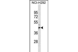 PE1 Antibody (C-term) (ABIN1536963 and ABIN2850052) western blot analysis in NCI- cell line lysates (35 μg/lane). (MPPE1 Antikörper  (C-Term))