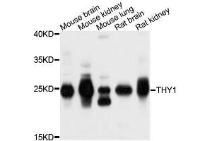 Western blot analysis of extracts of various cell lines, using THY1 antibody. (CD90 Antikörper  (AA 20-130))