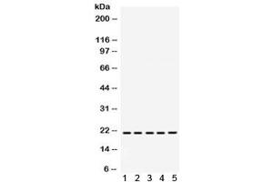 Western blot testing of 1) rat brain, 2) rat liver, 3) rat kidney, 4) human MCF7 and 5) human SW620 lysate with RAPA1 antibody. (RAP1A Antikörper)