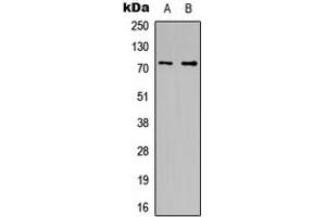 Western blot analysis of CDC16 expression in HeLa (A), HT1080 (B) whole cell lysates. (CDC16 Antikörper  (C-Term))
