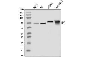 Western blot analysis of IPP using anti-IPP antibody (ABIN7599490).