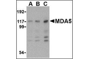 Western blot analysis of MDA5 in Daudi cell lysate with MDA5 antibody at (A) 1, (B) 2 and (C) 4 μg/ml. (IFIH1 Antikörper  (Center))
