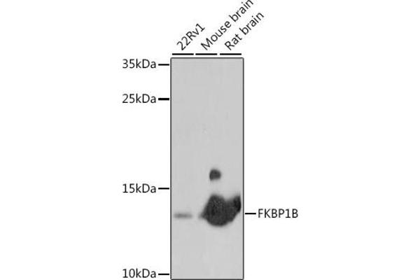 FKBP1B 抗体  (AA 1-80)
