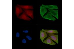 ABIN6255407 and ABIN6267589 staining Hela cells(30 min of UV treatment) by IF/ICC. (RELB Antikörper  (pSer573))