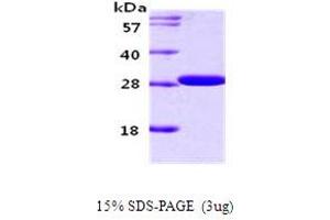 Figure annotation denotes ug of protein loaded and % gel used. (14-3-3 gamma Protein (YWHAG1) (AA 1-247))