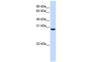 Image no. 1 for anti-Chromosome 18 Open Reading Frame 10 (C18orf10) (AA 180-229) antibody (ABIN6741302) (TPGS2 Antikörper  (AA 180-229))