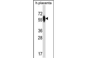 Western blot analysis in human placenta tissue lysates (35ug/lane). (P4HA3 Antikörper  (AA 274-303))