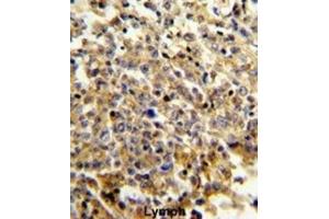 Immunohistochemistry (IHC) image for anti-Neutrophil Cytosolic Factor 4, 40kDa (NCF4) antibody (ABIN3003340) (NCF4 Antikörper)