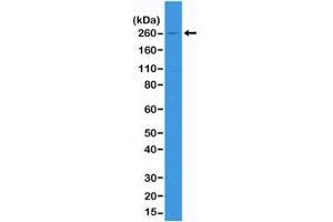 Western blot of A431 cell lysate using recombinant ACC antibody at 1:1000. (Rekombinanter Acetyl-CoA Carboxylase Antikörper)